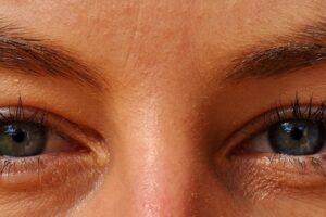 What Are Eye Floaters? featured image