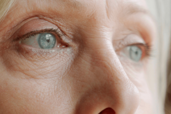 Are Eye Floaters Normal? featured image